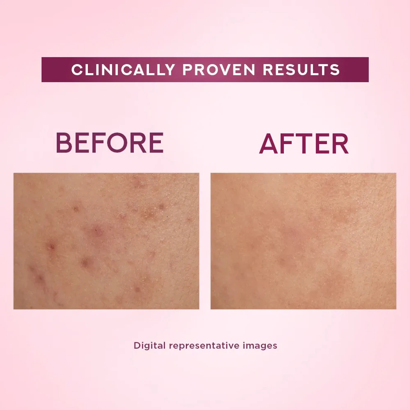 POND's WHITE BEAUTY ANTI SPOT FAIRNESS CREAM